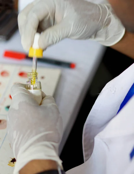 Labortechniker Fügen Reagenz Zur Blutprobe Hinzu Die Blutgruppe Der Probe — Stockfoto