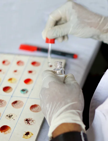 Labortechniker Fügen Reagenz Zur Blutprobe Hinzu Die Blutgruppe Der Probe — Stockfoto