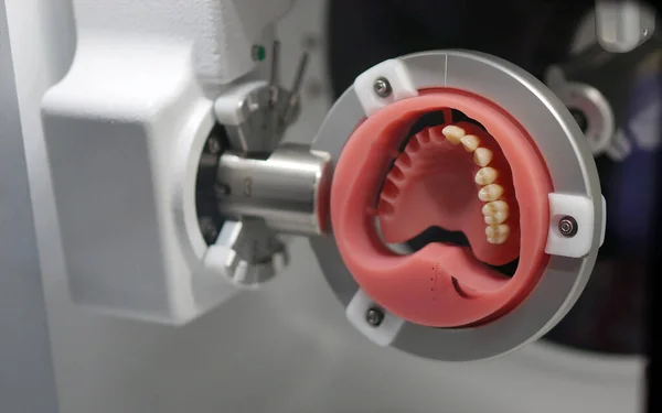 Fabricación Prótesis Dentales Humanas Con Máquina Clínica Odontológica — Foto de Stock