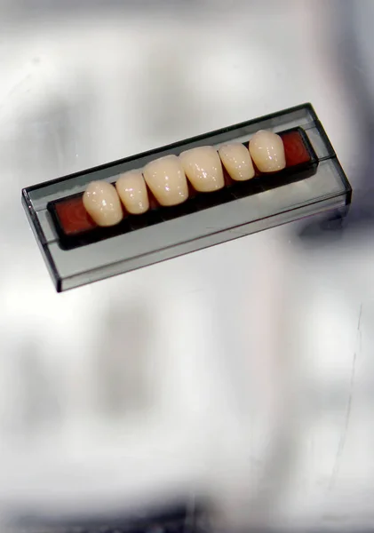 Satz Künstlicher Oder Falscher Zähne Zahnarztpraxis — Stockfoto