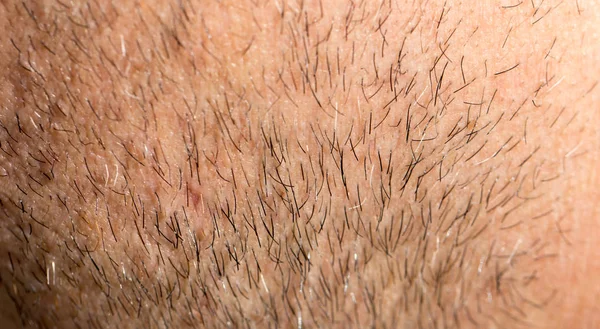 O cabelo na barba masculina. macro — Fotografia de Stock