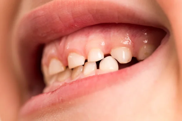 Baby teeth. macro — Stock Photo, Image