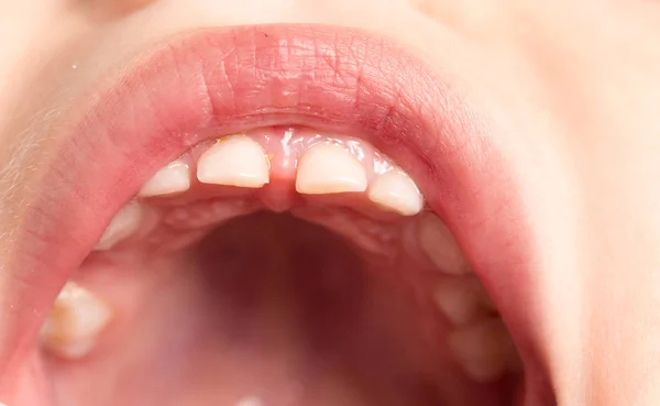 Süt dişleri. Makro — Stok fotoğraf