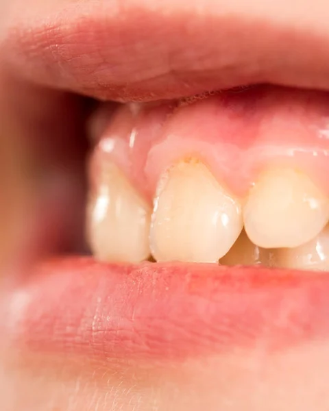 Süt dişleri. Makro — Stok fotoğraf