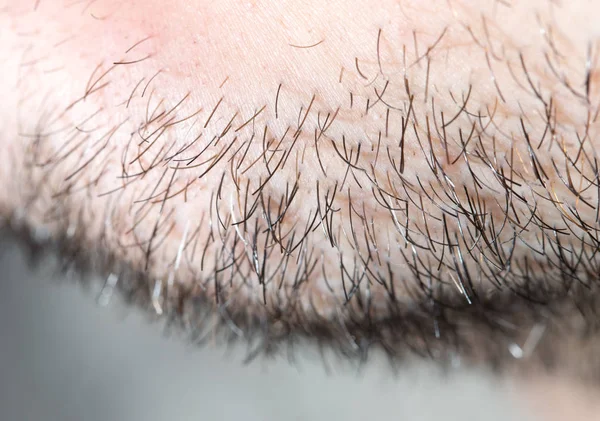 Restolho de cabelo em homens. macro — Fotografia de Stock