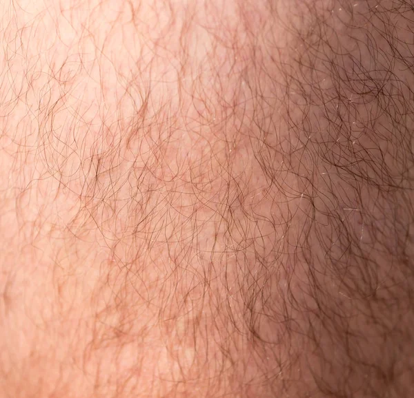 Vlasy na lidské kůži jako pozadí — Stock fotografie
