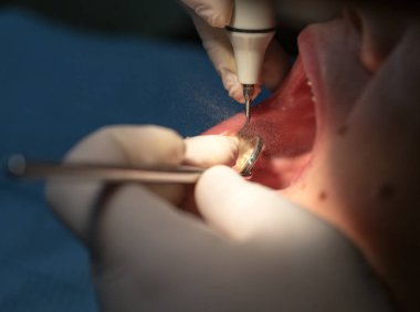 Diş Hekimliği diş tedavisi