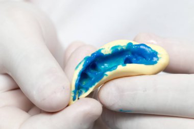 Doktor plastik protez diş hekimliği yapıyor