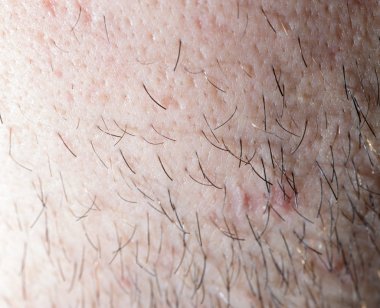 Erkek saç anız. Makro