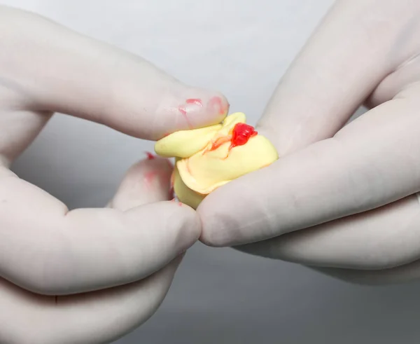 Arzt fertigt eine plastische Zahnprothese an — Stockfoto