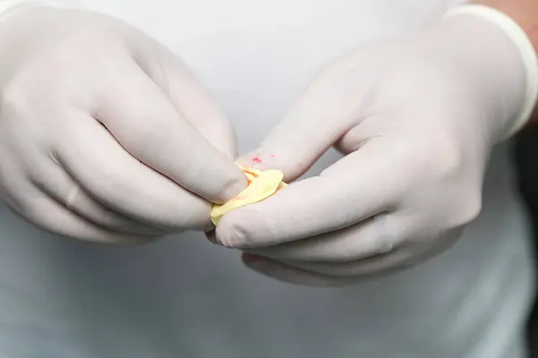 Doctor makes a plastic prosthetic dentistry — Stock Photo, Image