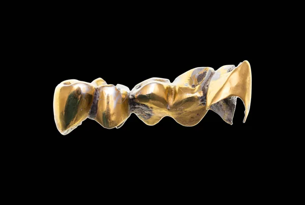 Metal teeth on a black background — Stock Photo, Image