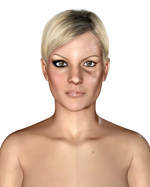 Illustration 3D d'une même peau saine et abîmée — Photo