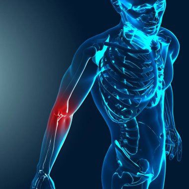 Vurgulanan acı dirsek ile tıbbi bir görüntü 3D render