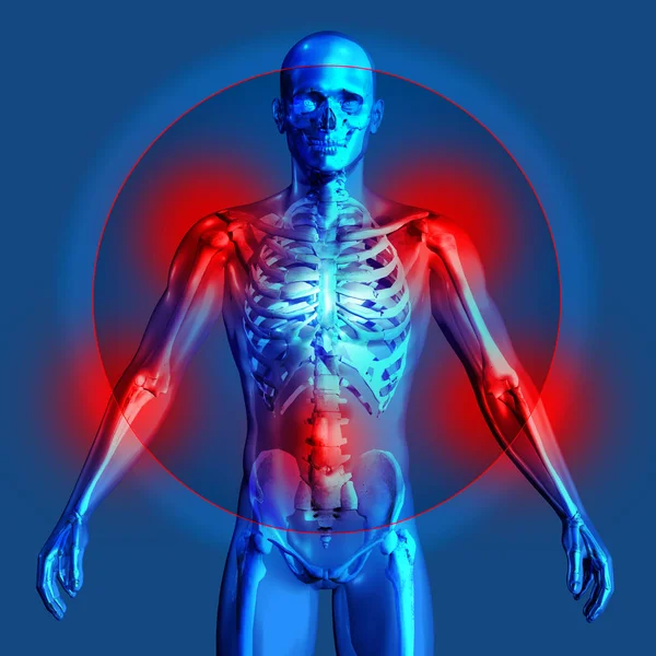 強調表示されている関節痛と医用画像の 3 d レンダリング — ストック写真