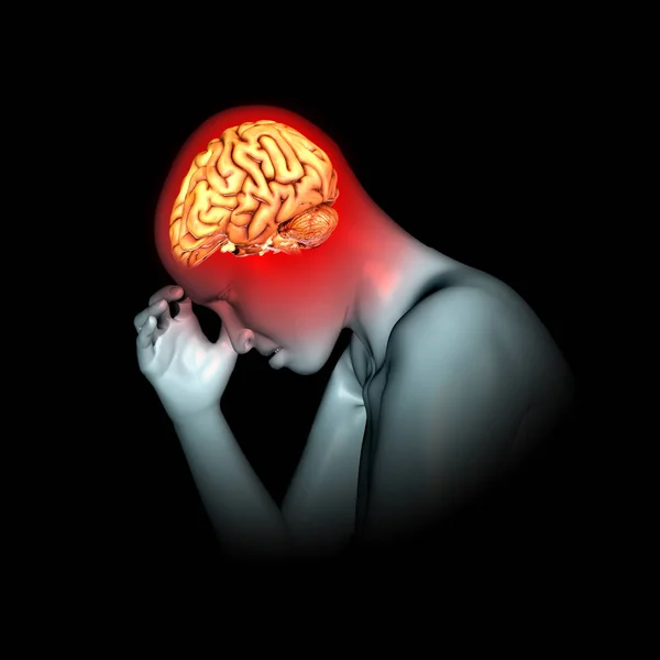 3D render kobieta z ból w głowie — Zdjęcie stockowe