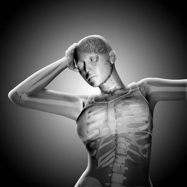 一个医疗的女性形象，抱着头在痛苦中的 3d 渲染 — 图库照片
