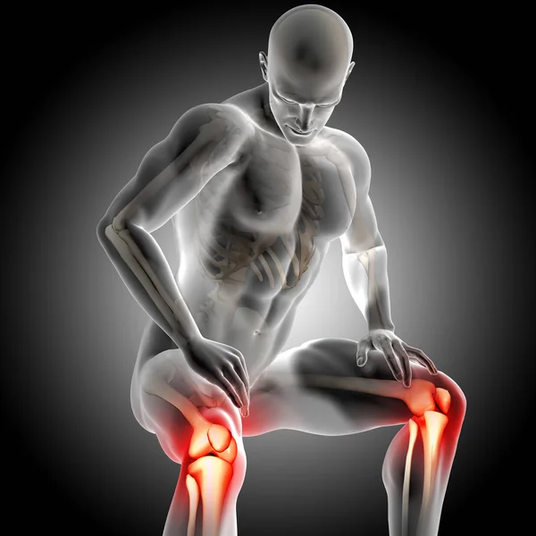 3D render of a male medical figure with knee joints highlighted