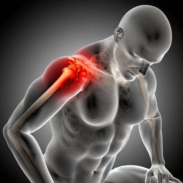 3D візуалізація чоловічої медичної фігури з болючими плечовими суглобами — стокове фото