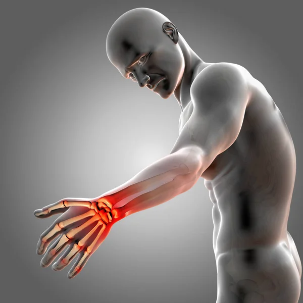 3D візуалізація медичної фігури чоловічої статі, що показує його болючу дотепність зап'ястя — стокове фото