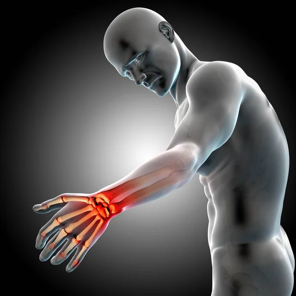 3D render of a medical male figure showing his painful wrist wit — Stock Photo, Image