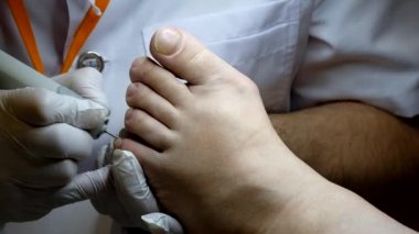 Pedikür uzmanı hasta ile çalışır