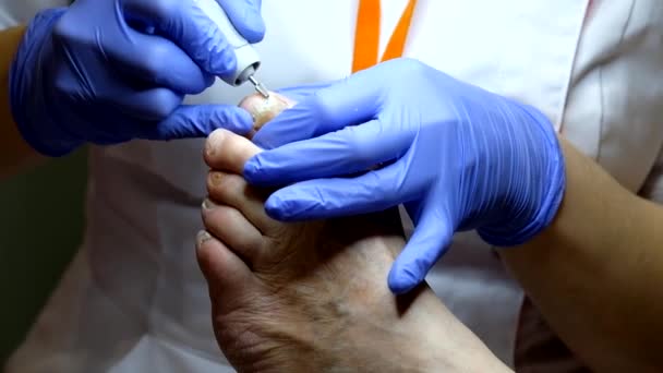 Pedicure specialist works with the patient — Stock Video