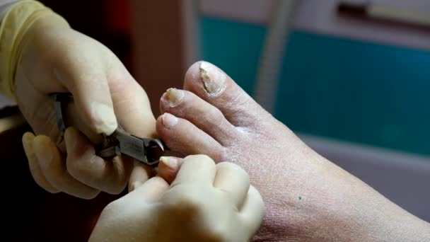 Pedicure specialista lavora con il paziente — Video Stock