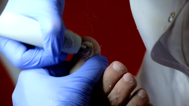 Pedicure specialist works with the patient — Stock Video