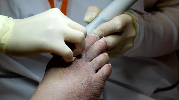 Pedicure specialist works with the patient — Stock Video