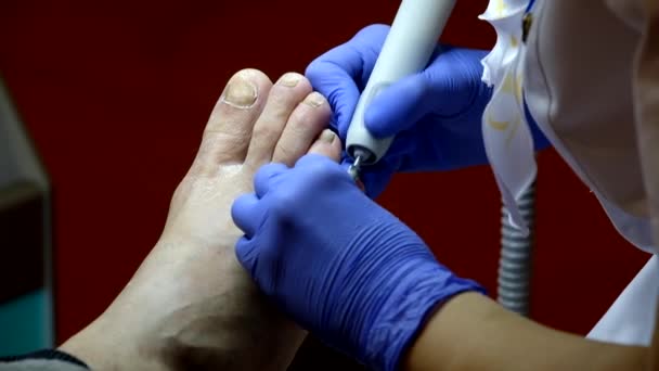 Fußpflege-Spezialist arbeitet mit dem Patienten — Stockvideo