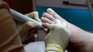 Pedikür uzmanı hasta ile çalışır