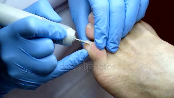 Pedicure specialist works with the patient — Stock Video