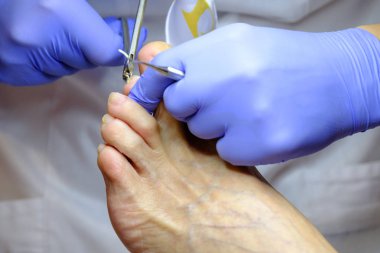 Pedikür uzmanı hasta ile çalışır