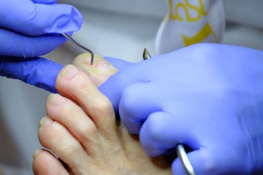 Pedikür uzmanı hasta ile çalışır