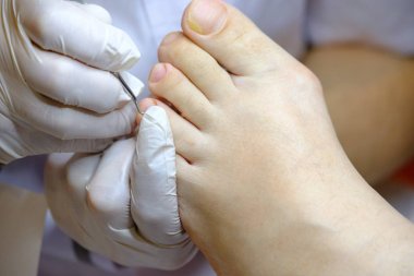 Pedikür uzmanı hasta ile çalışır