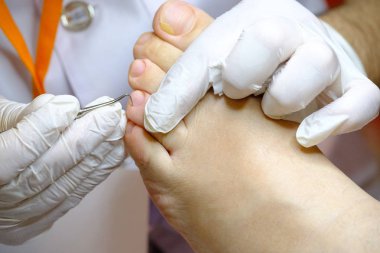 Pedikür uzmanı hasta ile çalışır