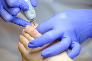 Pedikür uzmanı hasta ile çalışır