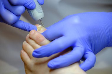 Pedikür uzmanı hasta ile çalışır