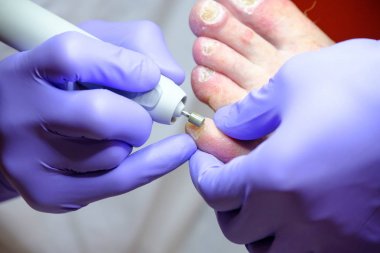 Pedikür uzmanı hasta ile çalışır