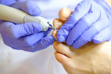 Pedikür uzmanı hasta ile çalışır