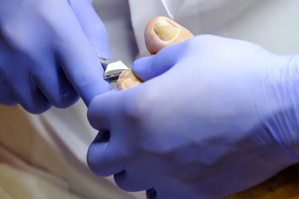 Pedicure specialist works with the patient — Stock Photo, Image