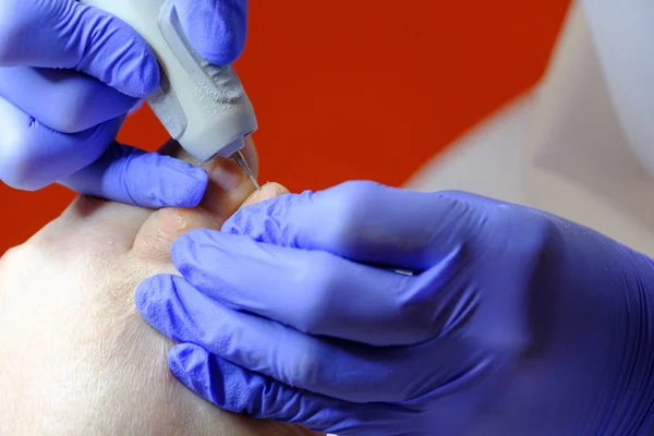 Pedicure specialist works with the patient — Stock Photo, Image