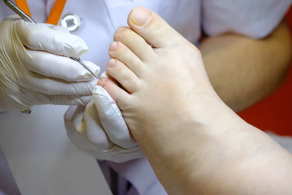 Especialista em pedicure trabalha com o paciente — Fotografia de Stock