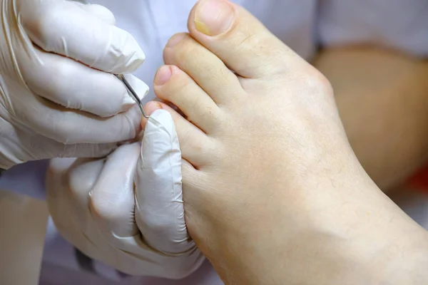 Especialista en pedicura trabaja con el paciente — Foto de Stock