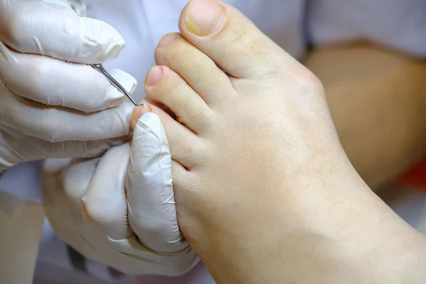 Especialista em pedicure trabalha com o paciente — Fotografia de Stock