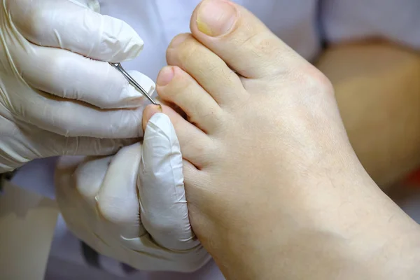 Especialista en pedicura trabaja con el paciente — Foto de Stock