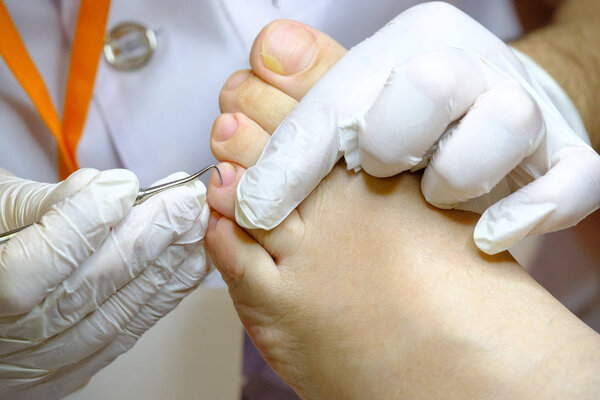 Pedicure specialist works with the patient