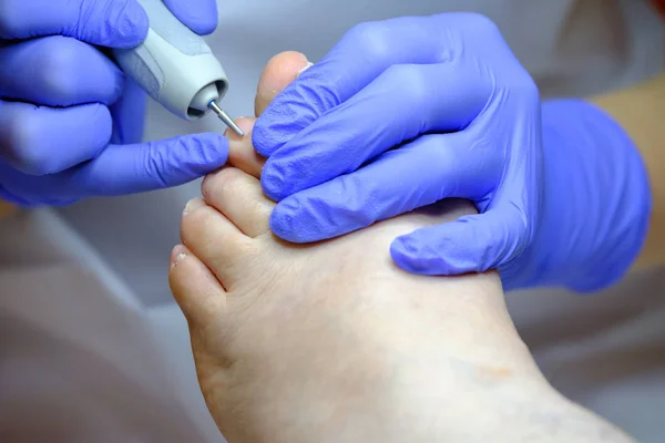 Especialista em pedicure trabalha com o paciente — Fotografia de Stock