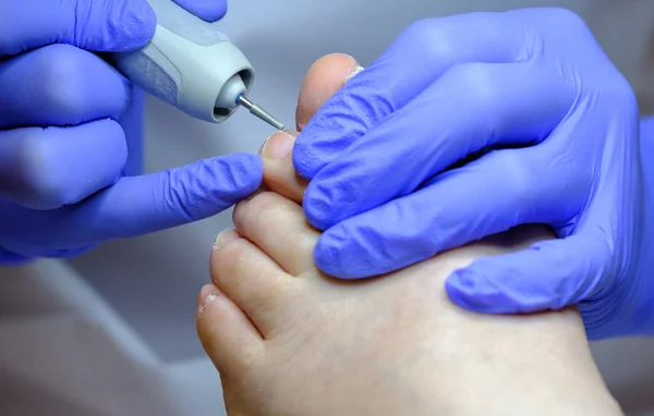 Pedicure specialist werkt met de patiënt — Stockfoto